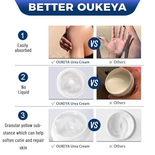 OUKEYA Urea Cream Intensive Foot, Hand & Body Cream for Very Dry, Cracked, Rough Skin on Heels, Knees & Elbows (12.35 Ounce)
