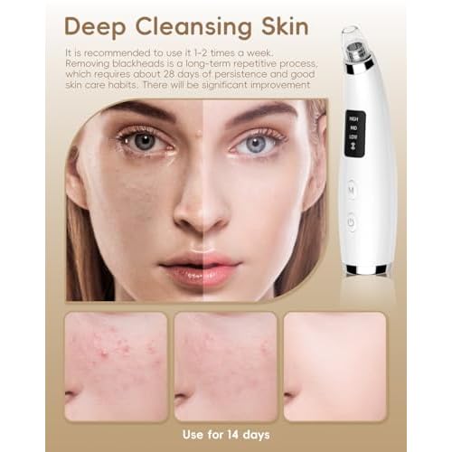 Rechargeable Blackhead Vacuum Pore Cleaner - 5 Attachments & 3 Suction Levels for Deep Facial Cleansing, USB-Powered Blackhead Remover for Women and Men (White)