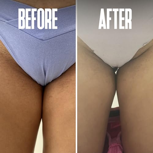 Divine Derriere Smoothing Solution Ingrown Hair Pads - Smooth, Relieve, Soften Skin - BHA & AHA Ingrown Hair Serum for Razor Burns and PFB Razor Bumps - Ingrown Hair Treatment for Bikini Area, 50ct