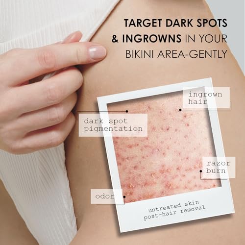 Brightening Bikini Spot Treatment with Azelaic Acid & Alpha Arbutin - Fragrance-Free, Daily Use