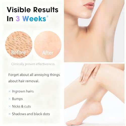 Gransumr White-Purple IPL Hair Removal Device for Body & Face, Painless & Fast, 86% Hair Reduction, 5 Modes, 8-Min Full Body Use