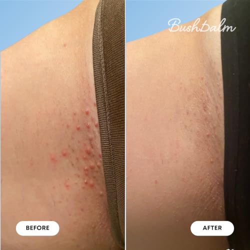 Bushbalm Nude Ingrown Hair & Razor Bumps Oil - Soothing Body Oil, 30ml