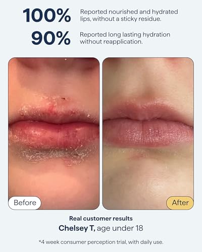 Remedy Science All-In-One Lip Treatment Pack of 2 with Ceramides, Peptides & Dimethicone