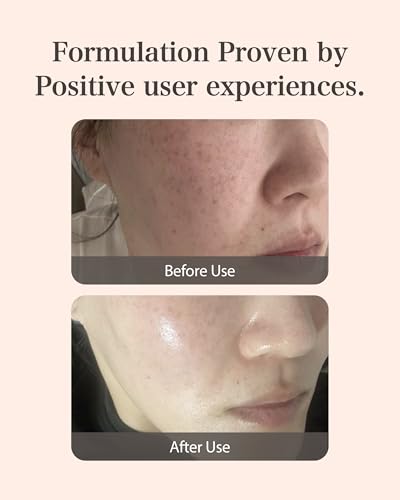 MASTINA Mastic Ampoule Serum - Face & Radiance, 0.51 Fl Oz, Pack of 1