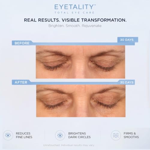 Serious Skincare Eyetality Morning Eye Cream for Dark Circles & Puffiness