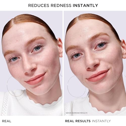 Calming Face Serum for Redness Relief with Colloidal Oatmeal - 24H Hydration, Sensitive Skin Care