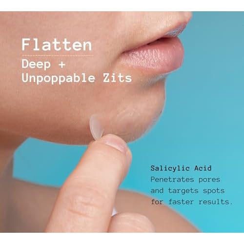 TKTK Pimple Patches Pimple Patches for Face Hydrocolloid Acne Patches Zit Patches for Chin and Nose Skin Care 5 Sizes 136 Count