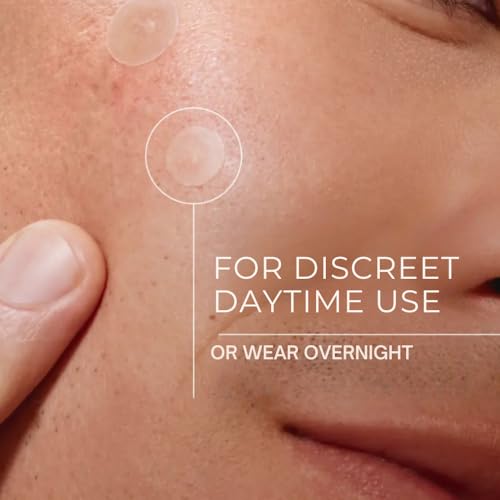 Pimple Patches ? Hydrocolloid Pimple Patches for Face and Skin, Invisible Acne Patches for Pimples, Whiteheads & Blemishes- Ultra-Thin Spot Covers for Day or Overnight Use- 108 Ct.