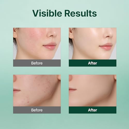 Vitamin C Gel Cream with Niacinamide for Brightened Skin - 50g