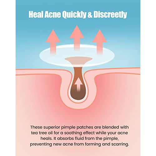 Pimple Patch 420 Counts 4 Sizes, Hydrocolliod Acne Patch for Face, Invisible Zit Patch with Tea Tree Oil & Calendula Oil, Blemish Patch, Vegan and Cruelty Free