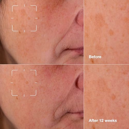 Clinique Even Better Clinical Dark Spot Clearing Vitamin C Face Serum - Mini Travel Size 1 Fl Oz