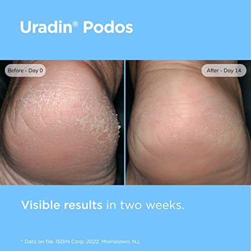 Foot Care Cream with Urea & Hyaluronic Acid for Cracked & Dry Feet - 2.5 fl oz