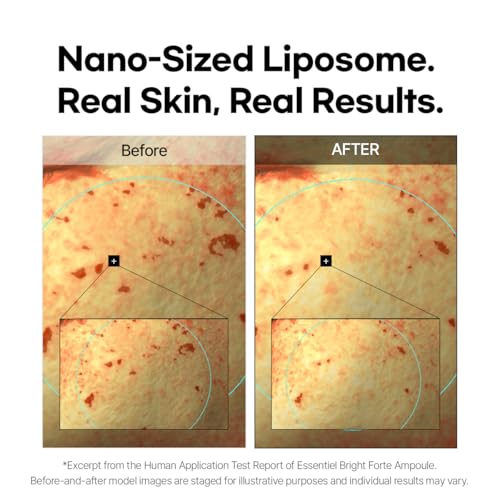 Brightening Facial Serum with Niacinamide & Vitamin C - Hydrating Anti-Pigmentation Formula