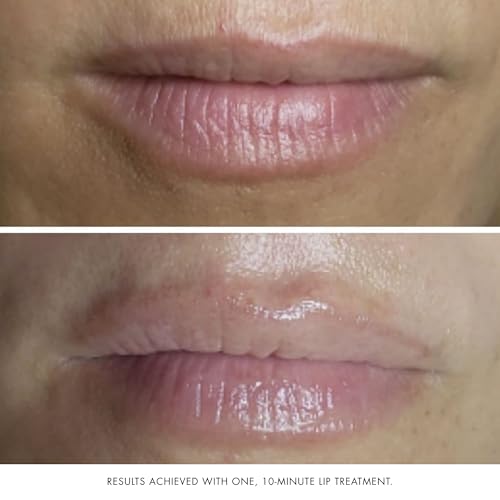 Collagen Face & Lip Mask for Anti-Aging - Dewy Skin, Fine Lines, Wrinkles - Vegan & Gluten-Free