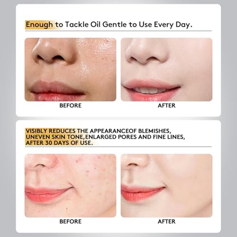 Jakuva 24k Gold Gel Facial Mask,SkinCare Facial Patch Collagen Face Mask for Moisturizing, Puffiness, Anti Wrinkle and Hydrateing Your Beautiful Face, 12PCS