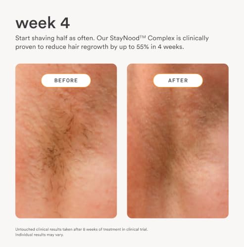 Nood Serum After Shave & Ingrown Hair Treatment - 3.3 Fl Oz - Soothes & Slows Regrowth