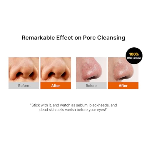 Hanskin Pore Cleansing Oil, Oil Cleanser for Face, Makeup Blackhead Sebum Remover, Korean Deep Pore Cleanser for Sensitive Skin [PHA] (10.14 oz)