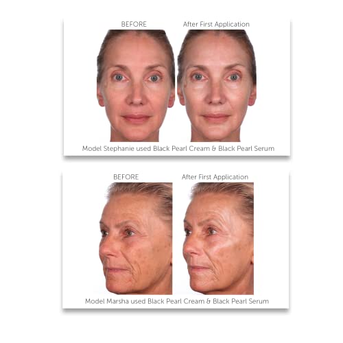 Serious Skincare - Black Pearl Deep Wrinkle Decrease Face Serum - Repair Deep Lines & Wrinkles - Increases Skin Hydration & Elasticity - Radiance Boosting for Luminous Glowing Skin 1 Fl. Oz.