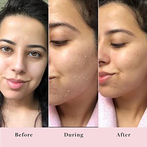 Saturday Skin Rub-A-Dub Refining Peel Gel & Hydrating Foam Cleanser - Natural, Brightening Face Wash for All Skin Types
