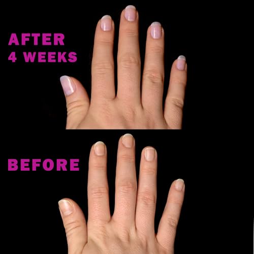 Perfect Formula Nail Essentials Kit ? 4-Piece Keratin Nail Strengthener and Growth - Nail Repair For Damaged Nails | High Gloss Finish, Nail Polish and Treatment for Longer, Stronger Nails