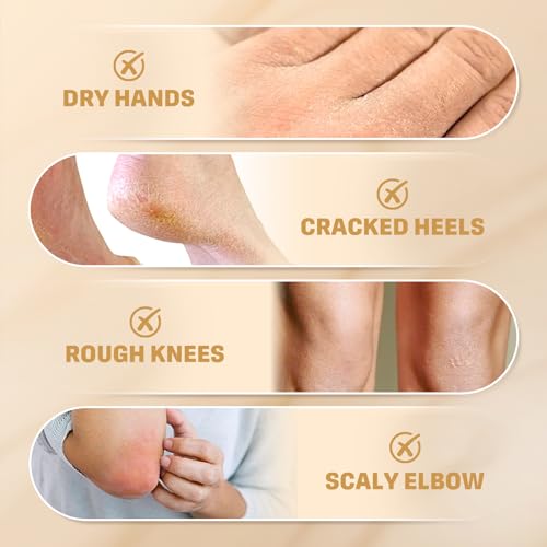Clyecfra 2Pack 60% Urea & 2% Salicylic Acid Foot Cream - Deep Hydration 300g