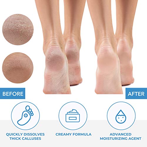 ForPro Professional Callus Remover 32 oz. Pack of 2 - Fast-Acting Foot Callus Treatment