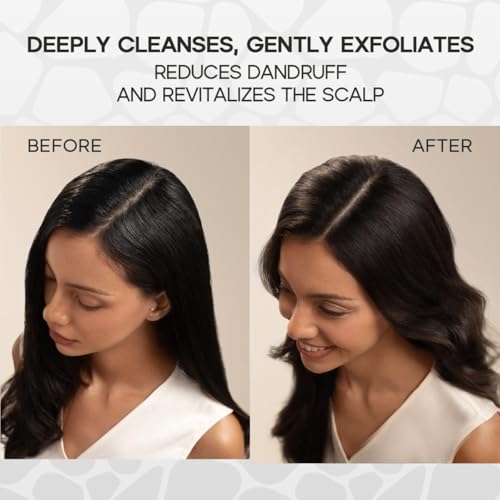 HALOVIDA Herbal Scalp Scrub for Dandruff & Hair Volume - Exfoliating Treatment