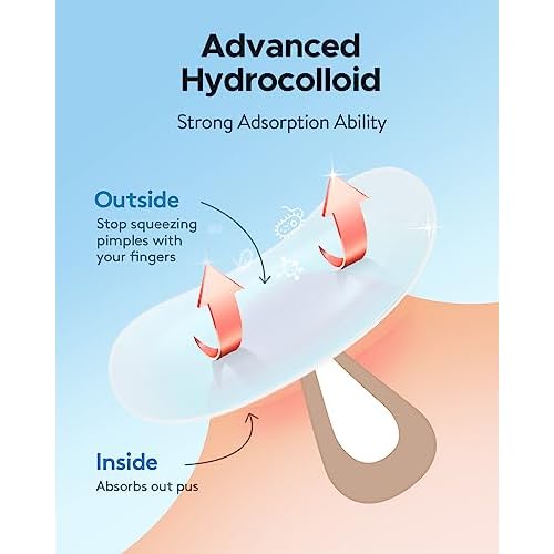 LitBear Acne Patches Large, Hydrocolloid Pimple Patches for Breakouts, Zit and Blemish, Large Acne Patches for Face, Chin, Back and Body with Tea Tree & Calendula Oil