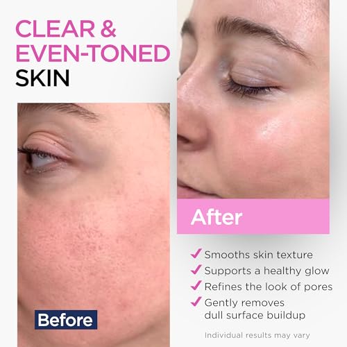 Ember Cloud Glycolic Acid Serum 15% & Lactic Acid 8 Oz Dual Exfoliation