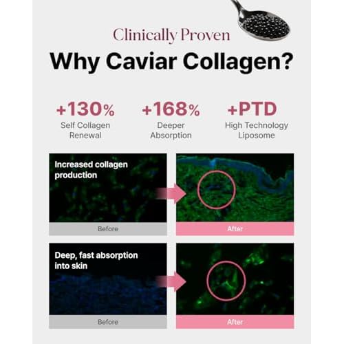 Delere Caviar AHA 3% Glow Toner | Korean Collagen Exfoliating Toner | Korean Exfoliator for Radiance, Collagen Skin Care, 250ml