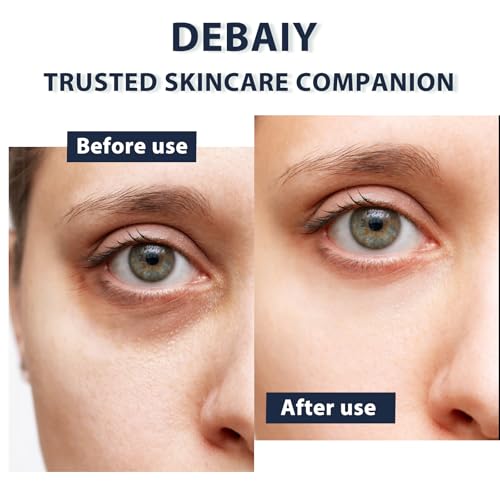 3% Caffeine Eye Cream for Dark Circles Puffiness & Bags Under Eyes Night Cream (3 Pack 15g Each)