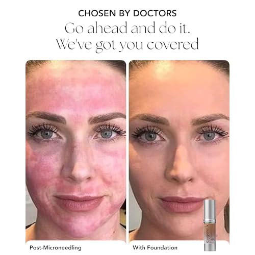 Oxygenetix Oxygenating Foundation ? Opal | Breathable Makeup for Face | Buildable Coverage with Weightless Feel | Longwear Foundation for Women | Safe for Sensitive or Laser-Treated Skin