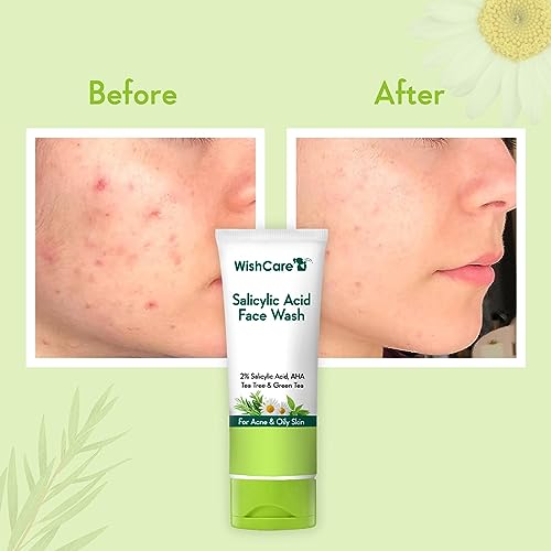 Majestic Pure Whipped Argan Oil Moisturizer Face Cream for Women & Men - With Vitamin E A, Collagen & Ceramides - Hydrates Dry Skin, Oily Skin, Reduces Appearance of Fine Lines ? 8oz