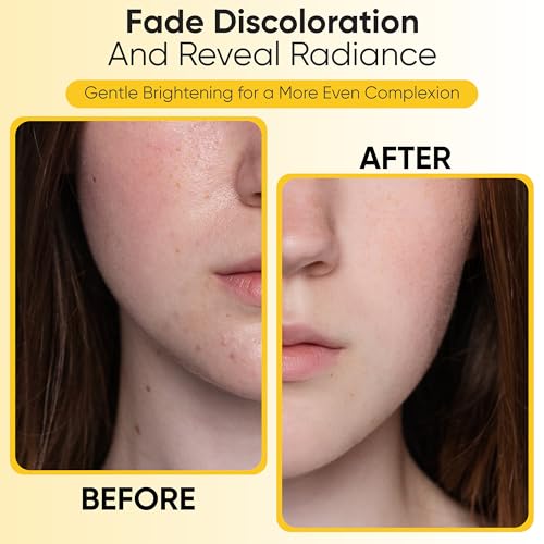 Azure Cosmetics Rose Gold Hydrating Peel Off Face Mask- Anti Aging, Toning & Rejuvenating - Removes Blackheads, Dirt & Oils - With Gold and Rose Water - Skin Care - 150mL / 5 fl.oz.