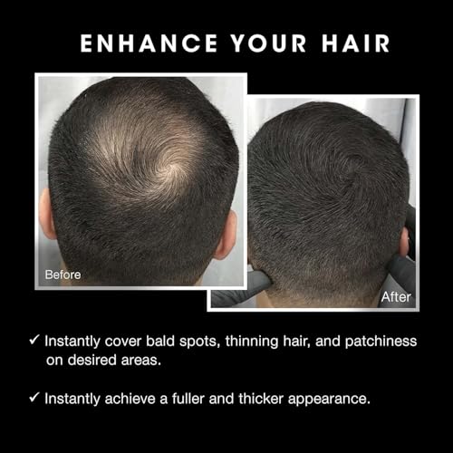 Pacinos Hair Fiber Kit for Thinning Hair - Black, Instant Coverage & Firm Hold