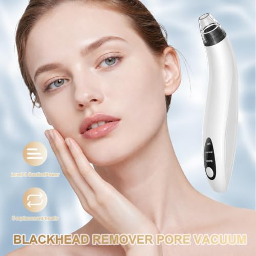 Blackhead Remover Vacuum Tool - Electric Pore Cleaner with Adjustable Suction (White)