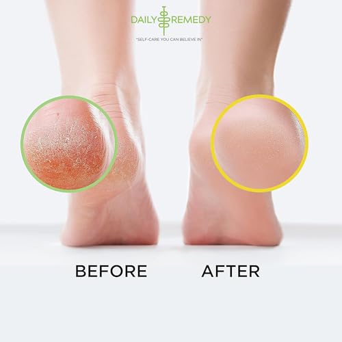 DAILY REMEDY Tea Tree Oil & Citrus Foot Soak Set, Pack of 2, for Foot Pain, Odor, Sore Feet, Athlete¡¯s Foot, Soften Calluses - Natural Blend & Salts, Made In USA