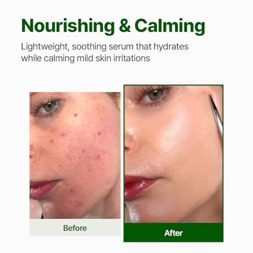 NACIFIC Cica PDRN Centella Serum (Centella Ampoule) 1.69 fl oz / 50ml, Korean Serum for Sensitive Skin, Calming & Hydrating Barrier Repair, Redness Relief, Korean Skincare