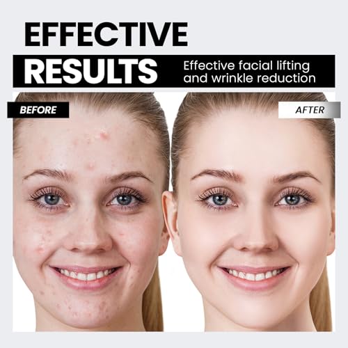 Microcurrent Facial Device,Latest Red Light Technology£¬Enhances The Ability to Lift The Face and Tighten The Skin£¬Facial Wrinkle Equipment£¬Smart Photon Micro-Current Device, Model:EP-300.