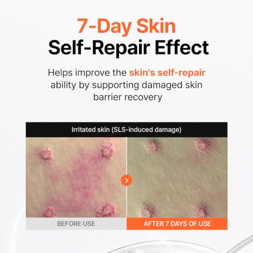 8 Barrier Water Glow Cream - Deep Hydration Moisturizer for Sensitive Skin