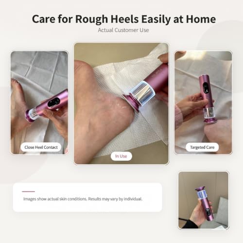 Pink 2-in-1 Electric Foot Callus Remover with Digital Display - Cordless Rechargeable Pedicure Tool
