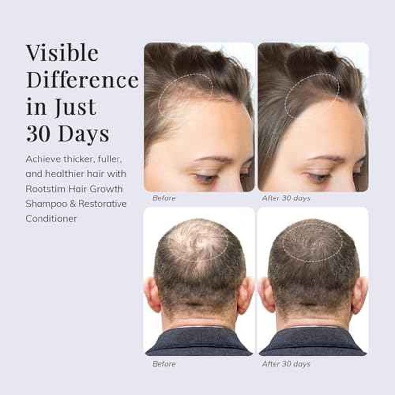 Hair Growth Shampoo and Conditioner Set - Rosemary & Biotin Shampoo and Conditioner for Hair Thickening - Botanical Boost for a Healthy Scalp, Hair Growth and Strengthen
