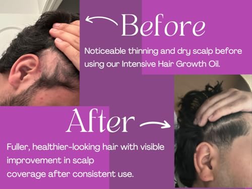 Natural Hair Growth Oil with Biotin & Botanical Oils for Thicker, Stronger Hair - 100ml