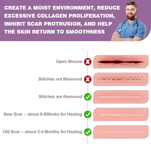 Silicone Scar Sheets 2 Rolls, Silicone Scar Tape (1.6¡± x 120¡± Roll-3M) Pro-Grade Silicone Scar Removal Strips, Reusable, Scar Tape for Wrinkles, Tummy Tuck, C-Section, Keloid, Burn, Acne Scars