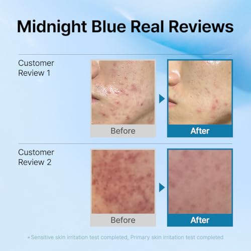 DearKlairs Blue Comforting Duo - Soothing & Hydrating Skin Care for Sensitive Skin