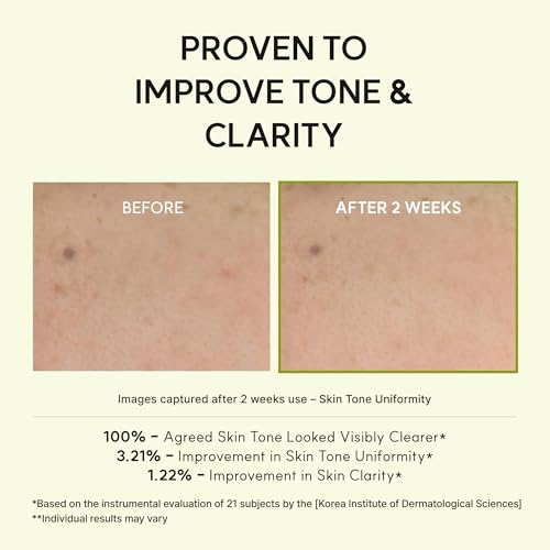 Vitamin C & Glutathione Facial Essence with Niacinamide - Skin Brightening, Dark Spot Care, 95 mL