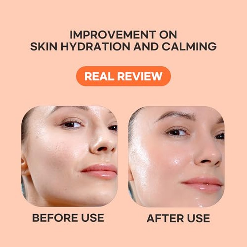Epielle Vitamin C Serum Sheet Masks (5pk) | Korean Skincare | Facial Sheet Mask | Kbeauty, Spa Gifts for Women