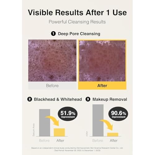 MISSHA Vita C All-In-One Bubble Foam Facial Cleanser 6.76 Fl oz / 200ml- Deep Pore Detox, Magic Bubbles with 99% Pure Vitamin C, Korean Face Wash - Removes Impurities, Makeup, Blackheads, Whiteheads