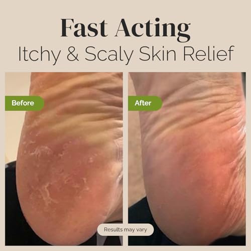 Puriya Tea Tree Oil Balm and Mother of All Creams with Mildly Earthy Scent Bundle Set, Plant Rich Wonder Balm, Moisturizing Cream for Dry, Itchy, and Sensitive Skin