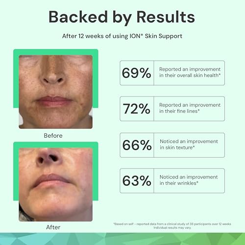 ION* Skin Support Face Mist 8 Fl Oz - Nourishing Mineral Hydrating Spray